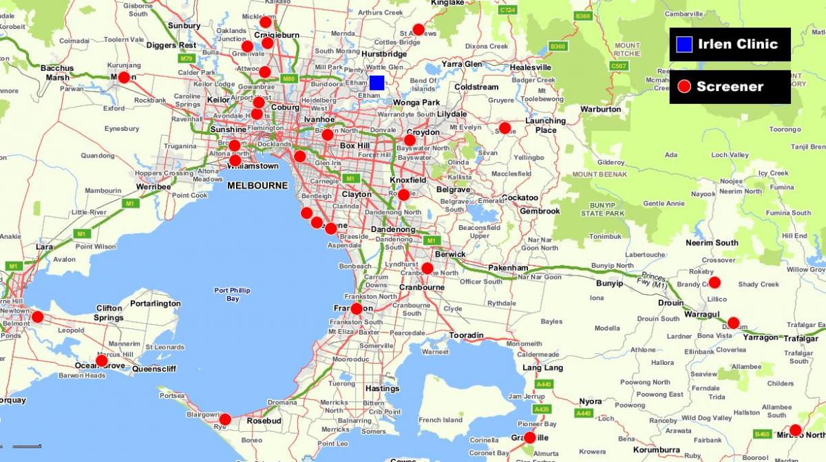 карта на поголема Мелбурн